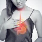 heartburn-vs-acid-reflux