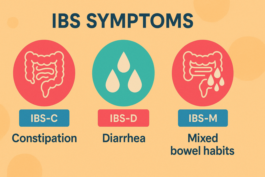 Infographic of IBS symptoms by subtype with stool pattern illustrations.
